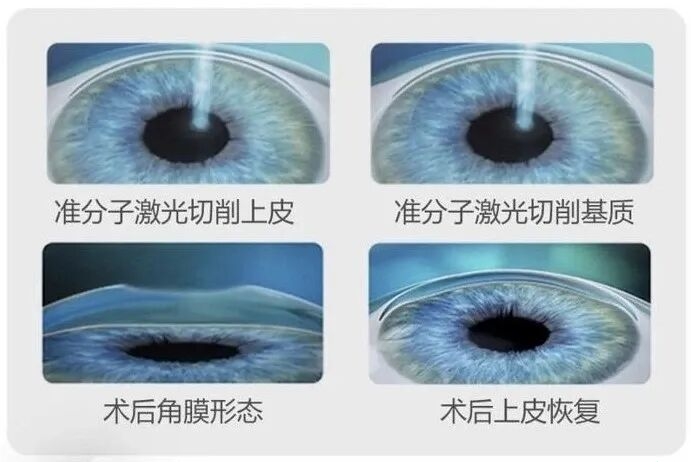 c772fa4422f37a17eccdf88fc465387b